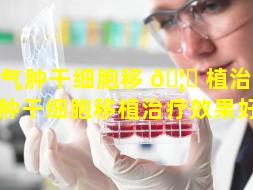 肺气肿干细胞移 🦉 植治疗（肺气肿干细胞移植治疗效果好吗）